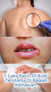 Obat Sipilis Kencing Nanah Gonore Paling Ampuh Triganos Bharata Kemasam 500 gram Isi 50 Kapsul Berlisensi BPOM Resmi Best Seller