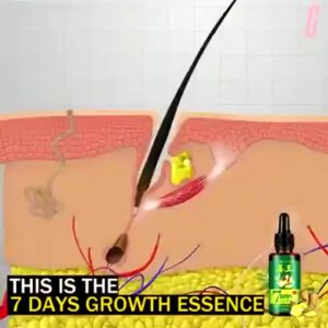 Serum 7 Days Hair Tonic Ginseng: Solusi Aman & Efektif Untuk Mengatasi Rambut Rontok