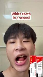 120g Pasta gigi pemutih gigi SP-6 probiotik pemutih gigi pemutih gigi dan penghilang karang gigi nenghilangkan noda dari karang gigi kuning pasta gigi pemutih menyegarkan nafas perawatan mulut Cegah kerusakan gigi