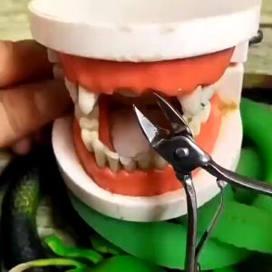 DIY Tooth Repair Kit Temporary Tooth Repai ⭐Tahan Lama 25 Tahun⭐Gigi Palsu Temptooth Penambal Gigi Isi Bahan Food Grade Kekerasan Tinggi Tahan Panas Cocok untuk Gigi Copotan Patah Gigi Celah Gigi dan Lubang Gigi Temporary Tooth Repair Penambal Gigi Tempto