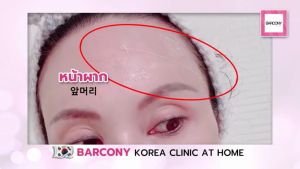 31cm โปรแกรมร้อยไหมเกาหลี ยกหน้า ยกคอ ยกกระชับ เส้นไหม 120 เส้น