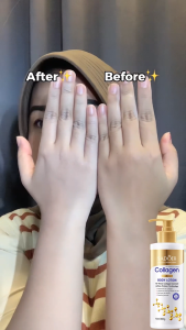 Collagen Whitening Body Lotion pemutih kulit Cepat Pelembab Dan Meremajakan Kulit Menghilangkan Kusam Kulit Mencerahkan Warna Kulit Wangi Tahan Lama Menghilangkan Kulit Ayam 300g