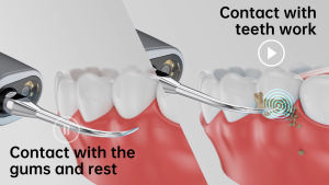 CURVY MOON M1 Ultrasonic Scaler with Smart Soft/Hard Detection 5MP Camera APP Connect Visual Tartar Remover Safe for Gums