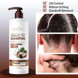 Coconut Oil Shampoo 500ml Oil Control Total Repairing Damaged Hair Nourish Scalp Relieve Dandruff Itchy Control