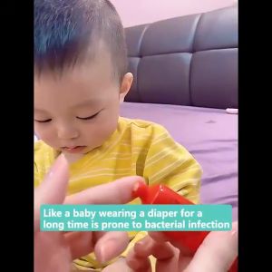 Australia Lucas Papaw Ointment: Lip Balm, Burn Ointment & Mosquito Bite Relief