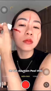 Combo Lycos Không Thể Rời Xa – Peeling AHA/BHA + Gel Dưỡng Ẩm Dịu Nhẹ Cho Mọi Loại Da