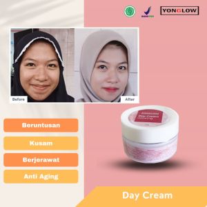 Yonglow Skincare Day Cream: Krim Siang Resmi BPOM Formulasi dr Yong Pemutih Kulit Wajah Penghilang Beruntusan Bekas Jerawat Wajah Pembersih Muka Ampuh