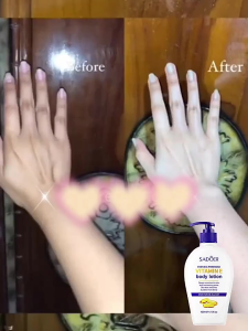 KADAIE SADOER Vitamin E Lotion Whitening Collagen Lotion Body lotion pemutih badan permanen hand body pemutih kulit blecing whitening Pulihkan pemutihan kulit memutihkan seluruh tubuh 400ML