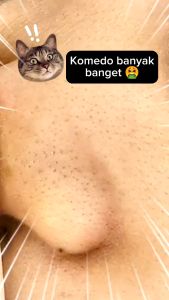 SACHET VIENNA CLEANSING PORE STRIPS CHARCOAL & BAMBOO / MASKER KOMEDO SASHET