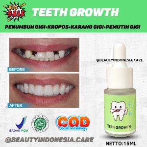 PENUMBUH GIGI OMPONG | GIGI LANGSUNG TUMBUH BARU | TEETH GROWTH | Penumbuh Gigi Ompong 7 Hari dan Penghilang Karang Gigi PENUMBUH GIGI DEWASAAnak balitaRemajaGigi kroposPatah BerlubangGigi hitamGigi kuning