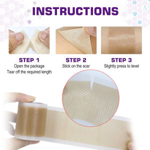 1Roll Silicone Scar Sheets Removal Strips Scar Reducing Treatments for Surgical Scars C-Section Stretch Mark Patch Away Wound