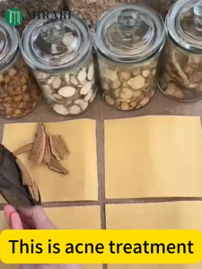 Whitening Face CreamEffective Remove Pimples Quickly Pimple Tea Tree Acne Treatment Essence Reduces Acne Scars Minimizes Pores Anti-Aging Anti-InflammatoryWithout Irritation Facial Moisturizer Inhibits Acne Acne Scar Remover 50g