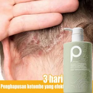 LIFUSHAShampo anti ketombe Shampo rambut rontok mite removal Shampo penumbuh rambut cepat Jahe ketombe / oil control 500ml