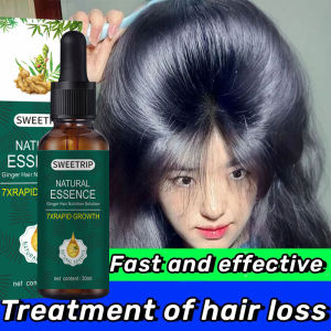 SWEETRIP Penumbuh Rambut Cepat Dan Tebal Serum Penumbuh Rambut 30ml Penumbuh Rambut Botak Pria Menyehatkan Kulit Kepala&Meningkatkan Regenerasi Rambut Penumbuh Rambut Botak Paling Cepat Original 100%