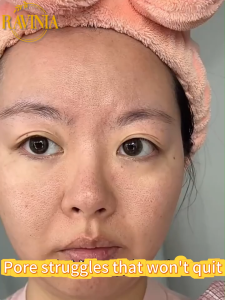 【RAVINIA】Pore minimizer serum 50ml Repair enlarged pores pitted skin Pore Tightening Whitening&Smoothing&Moisturizing facial skin