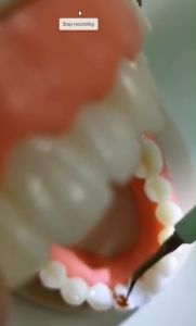 声波电动洁牙器 Electric Teeth Cleaner 清洁护理洗牙器 牙刷 去牙垢烟渍菌斑 电动牙刷 牙齿 清洁口腔 洗牙 牙结
