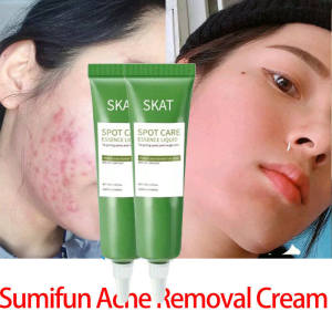 Effective Anti Acne Cream Ampuh Mengatasi Jerawat dan Bekas Jerawat Cream Jerawat Face Skin Care/Penghilang Bekas Jerawat/Penghilang Jerawat/Cream Jerawat dan Bekas Jerawat-💖Uiabgt
