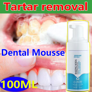 3-Day Teeth Whitening: Brighter Smile with Mousse Toothpaste