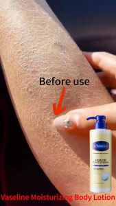 【🔥Special Offer】Body lotion 500ml,Permanent whitening lotion skin care brightening,Moisturizing and anti-aging removing melanin refreshing and not greasy