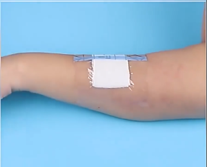 5/10/15CM*5M Waterproof Wound Adhesive PU Film Adhesive Transparent Tape Surgical Wound Adhesive Tape