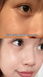Thanh Lăn Mặt Nạ Đất Sét Hyalu-C The Originote Trắng Da Mặt Làm Săn Chắc Dan Kiểm Soát Dầu Vitamin C Clay Mask Stick