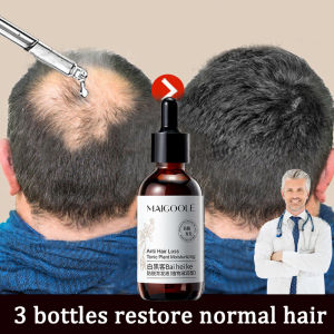 Original Hair Growth Serum Anti Hair Loss hair growth oil Hair Tonic 60ML Hair Fall Scalp serum rambut Say Goodbye To Baldhead hair care