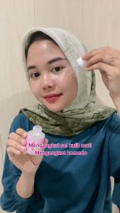 Oh My Skin! EXFO TIME! SERUM 3x Lebih Cepat Hempas Komedo dan Bekas Jerawat