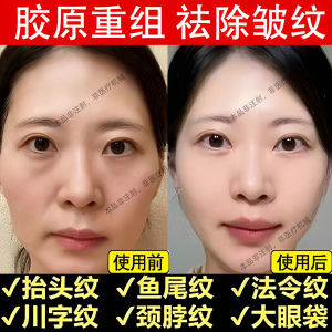 Dofeni Peptide Collagen Facial Fillers Anti-Wrinkle Firming Powder Cream for Beauty Salons Anti-Aging Skin Care Product