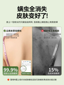 Flea Bag Lice Control Home Use Anti-pest Herbicide Bedding Medicine Kit Fungus Killing Special Purposes Dormitory Household