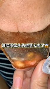 โคลนมาส์กลอกสิวเสี้ยน โคลนมาส์กสมุนไพรจีน สูตรเข้มข้น ขจัดสิวได้อย่างหมดจรด ไม่ทิ้งรอยแดง และไม่ก่อให้เกิดการแพ้ ผิวนุ่มชุ่มชื่น