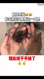 ✅100% Original Yoky Hair Straightener Comb Negative Ion Anti-Scalding Hair Brush Hair Styling Tool
