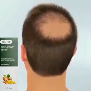 penumbuh rambut Hair growth serum penumbuh rambut botak serum penumbuh rambut 20ml serum rambut rontok Penumbuh Rambut Cepat Anti Rontok Mengatasi Botak
