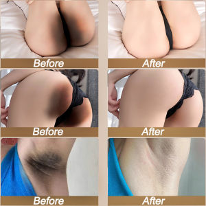 Niacinamide Whitening Body Lotion 320ml: Solusi Pemutih Seluruh Tubuh & Miss V