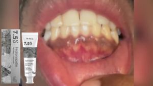 oralhoe | Oralhoe 7.5% Hydroxyapatite Toothpaste 120g Cleansing Stains and Plaque Enamel Repair Toothpaste Freshens Breath Oral Care