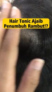 YURIZUMI Tonic Rambut Ekstrak Ginseng Penghalang Rontok dan Perawatan Rambut Ruteng 250ml