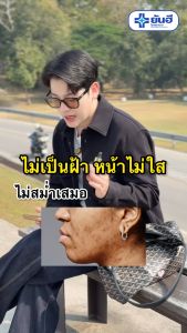 Yanhee anti melasma serum ยันฮี แอนตี้ เมลาสม่า เซรั่ม ฝ้า กระ จุดด่างดำ จากยันฮี เลือนฝ้า ของแท้ มีเก็บปลายทาง