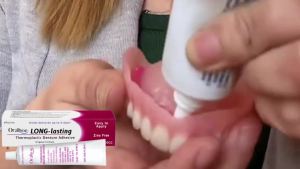 High Quality 【 Spot inventory 】ORALHOE Thermoplastic Denture Adhesive  Long-lasting Effect  Not Damage Dentures Or Gums Mild Denture Adhesive Seamless Fit Thermoplastic Denture Adhesive Comfortable Portable Oral Health Care Long Lasting Reu