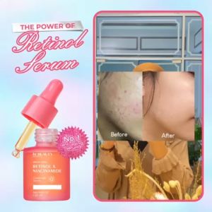 Serum Retinol dan Niacinamide Terbaru By KF Skin