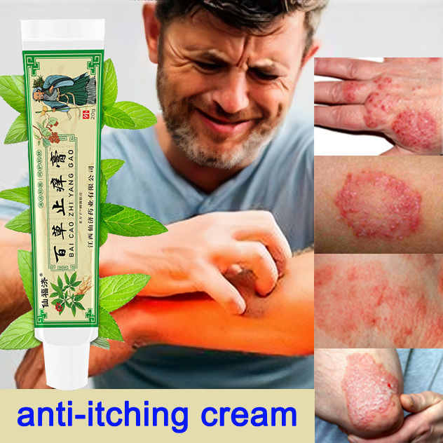 Eczema Cream Quickly sterilize and relieve itching External use on the