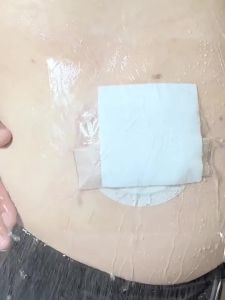 Ostomy Shower Cover Waterproof Ostomy Bag Covers Shower Guard Stoma Shower Shields Colostomy Bathing Bags Shower Protector Adhesive Bandage with Non-Stick Pad for Showering 10\"x12\" 7Pcs