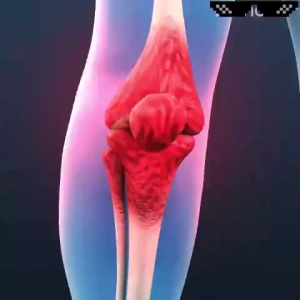 Bee Venom joint Pain relief cream joint and bone Treatment Gel supplement treat joint knee pain toe bone pain relief of joint pain professional treatment knee shoulder Neck lumbar