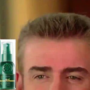 Hair Growth Serum Ginger Growth Liquid Anti-Loss Hair Growth Essential Oil Hair Care Essence For Hair Growth ginger shampoo300ml/ginger Hair Growth Essential30ml