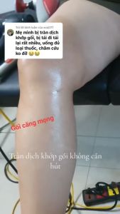 baomeiquan Kem Dưỡng Ngựa Keo Massage Condensed Horse Chestnut Cream Vai Cổ Khớp Cơ Thể Cơ Thể 500ml