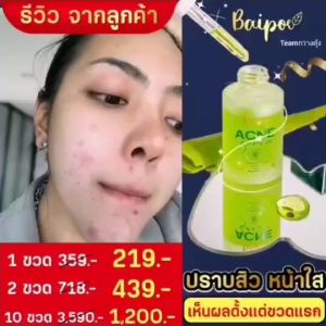 เซรั่มใบปอ สำหรับสิว รอยสิว จุดด่างดำ 30 มล.