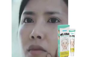 Cream penghilang flek hitam Whitening Freckle Cream Remove Dark Spots /salep flek hitam membandel Jerawat/penghilang flek hitam di wajah