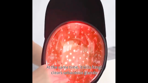 Rechargeable Lasers Hair Growth Cap Red Light Therapy for Hair Regrowth Scalp Care Oil Control With 120 LEDs LLLT LASER ANTI-LOSS CAP
