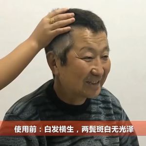 Cover Gray Hair Without Touching The Scalp Lingzhi Water A Black Hair Dye