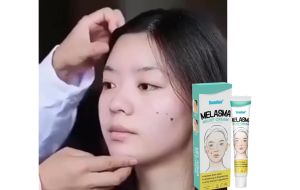 Penghilang Flek Hitam di Wajah: Cream & Salep Ampuh