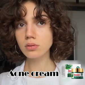 Acne Face Cream by SADOER Pimple Acne Remover Acne Scars Removal for Face Pimple Marks Remover