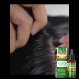 EELHOE Rosemary Hair Essential Oil 30ml Hair Loss Treatment Lmproves Bifurcation Eliminates Ltching